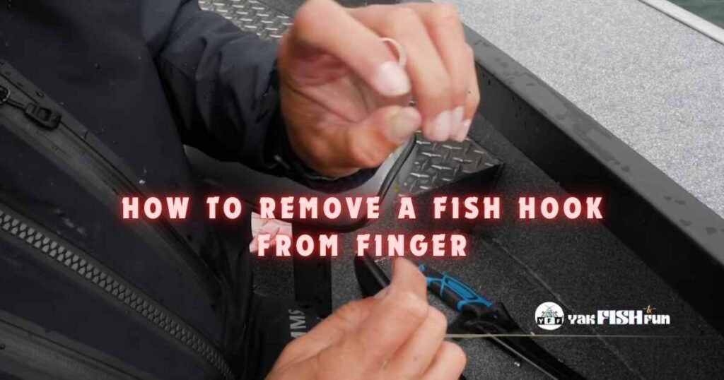 how to remove a fish hook from finger